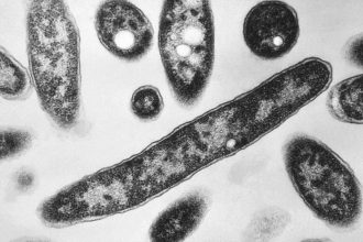 V hotelovej virivke v Demanovskej Doline nasli Legionellu