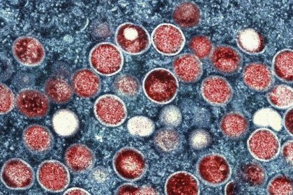 Opicie kiahne na Slovensku Co o nich vieme Takto sa prejavuj ria a tieto skupiny lud patria medzi rizikov