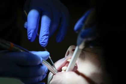 Ziadne korunky ani implantaty Vedci chcu prinutit telo aby si nove zuby samo vypestovalo
